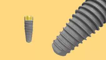 NobelReplace Conical Connection.png (