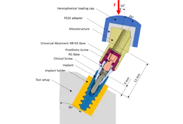 Nobel Biocare N1 schematic view