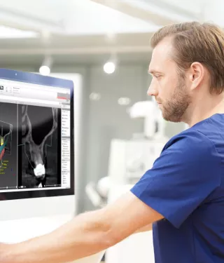 All-on-4® digital workflow