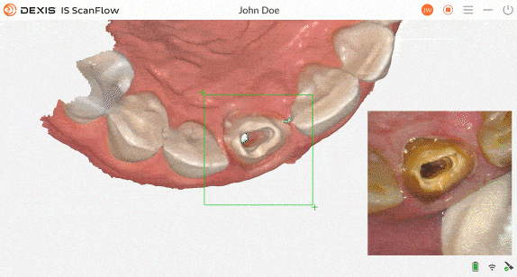 Dexis's scan quality