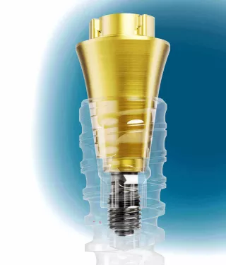 Nobel Biocare N1 Base