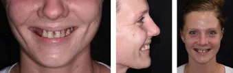 Pre-operative assessment