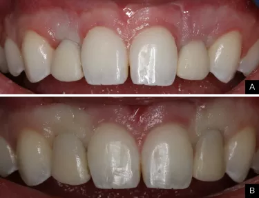 Initial and contoured provisional from the Dr. Mark Hagan case